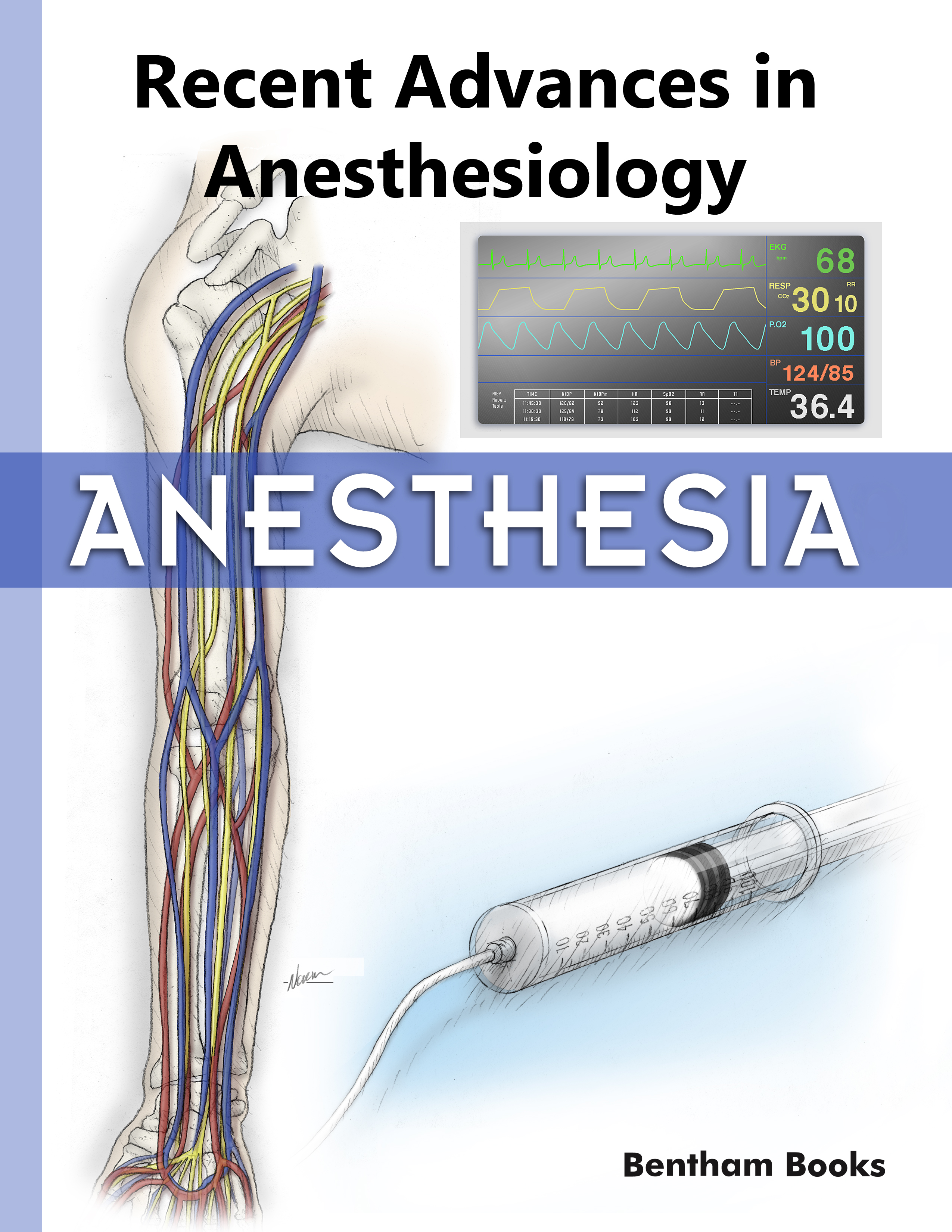 Recent Advances in Anesthesiology Recent Advances in Anesthesiology