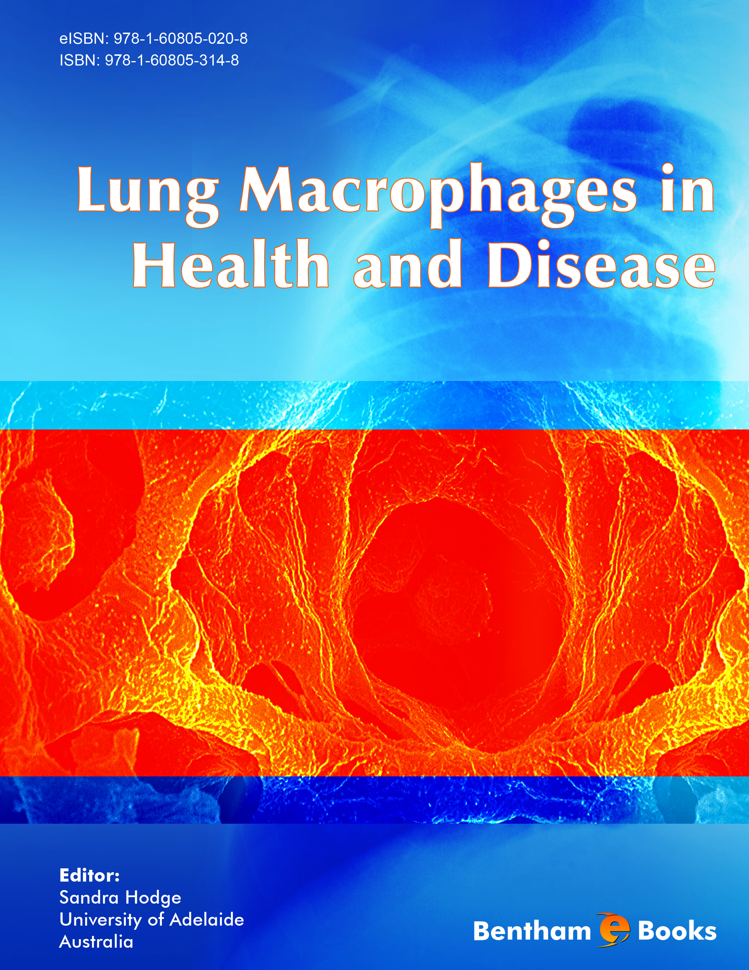 Lung Macrophages in Health and Disease Lung Macrophages in Health and Disease