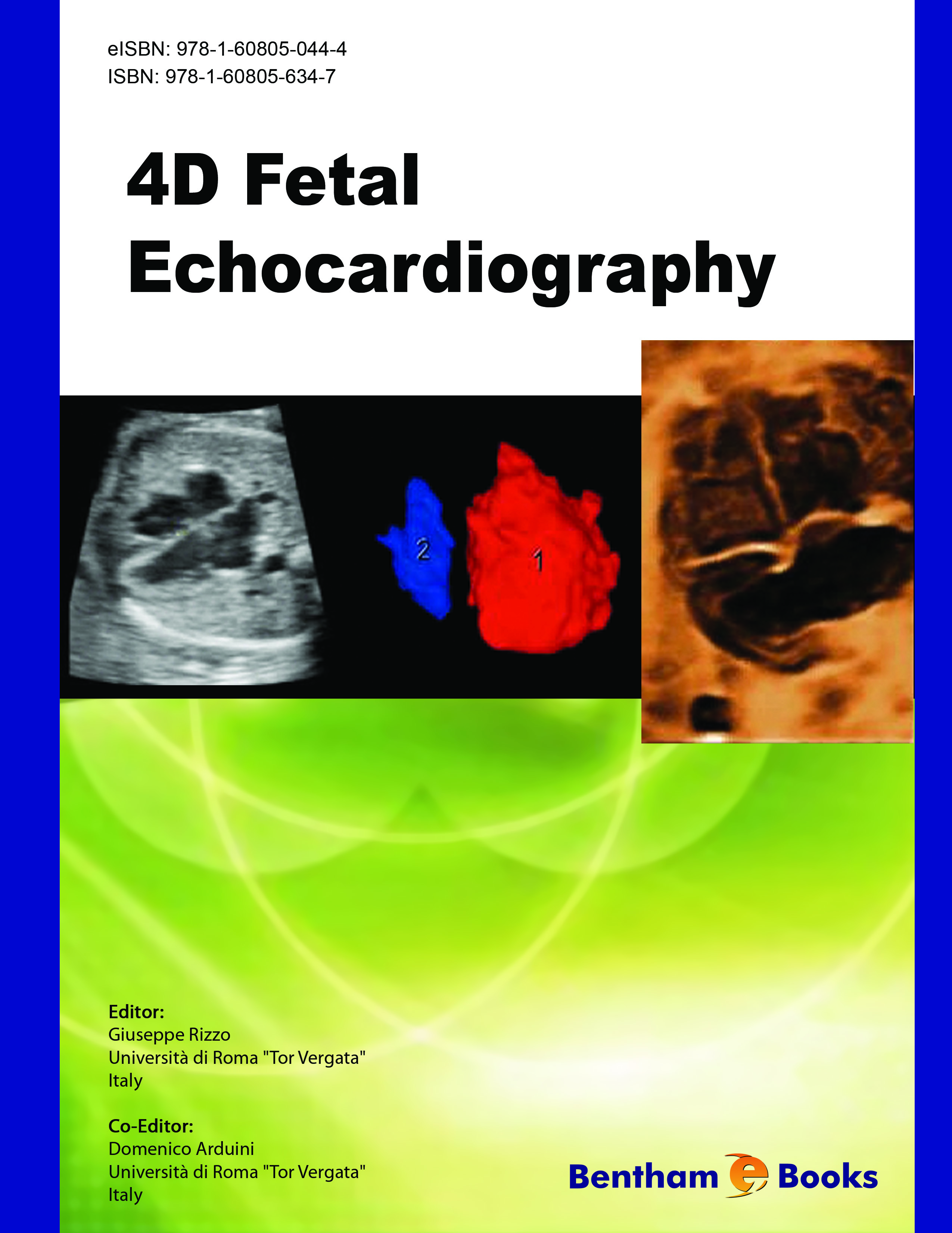 image of 4D Fetal Echocardiography