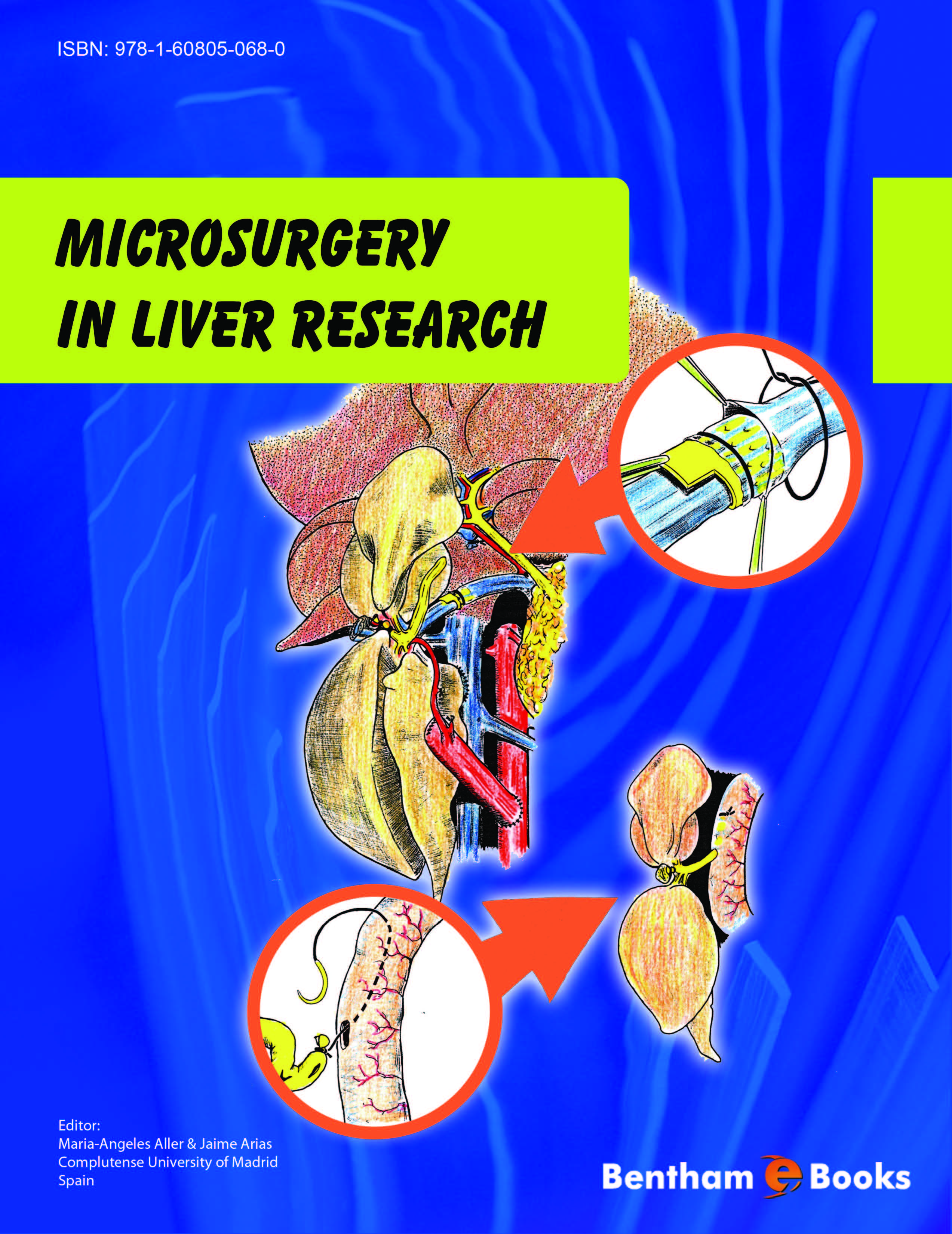 Microsurgery In Liver Research Microsurgery In Liver Research