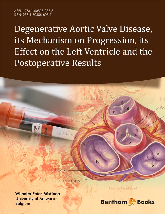 image of Degenerative Aortic Valve Disease, its Mechanism on Progression, its Effect on the Left Ventricle and the Postoperative Results