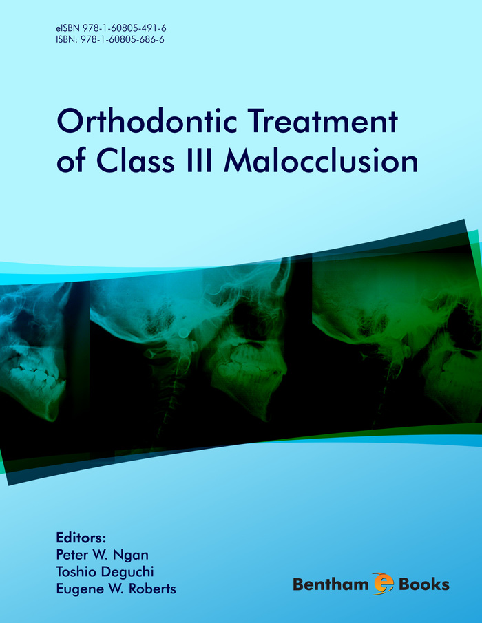 image of Orthodontic Treatment of Class III Malocclusion