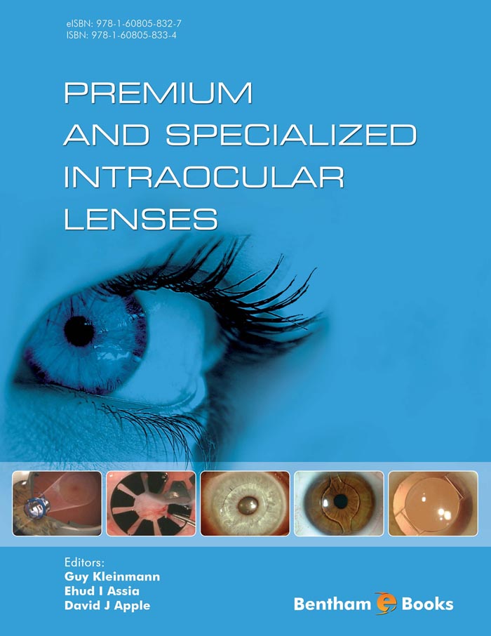 image of Phakic Intraocular Lenses