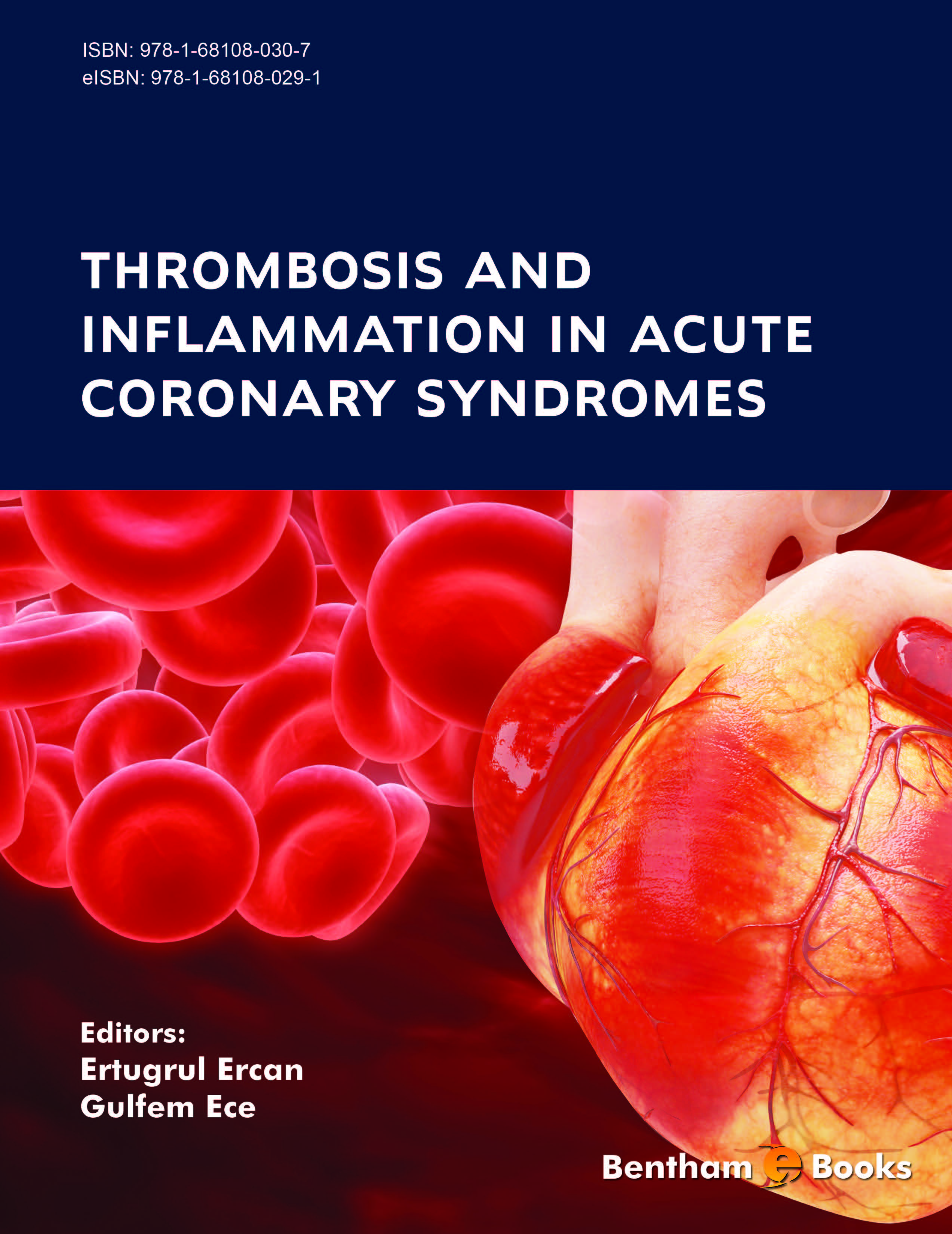 image of Thrombosis and Inflammation in Acute Coronary Syndromes