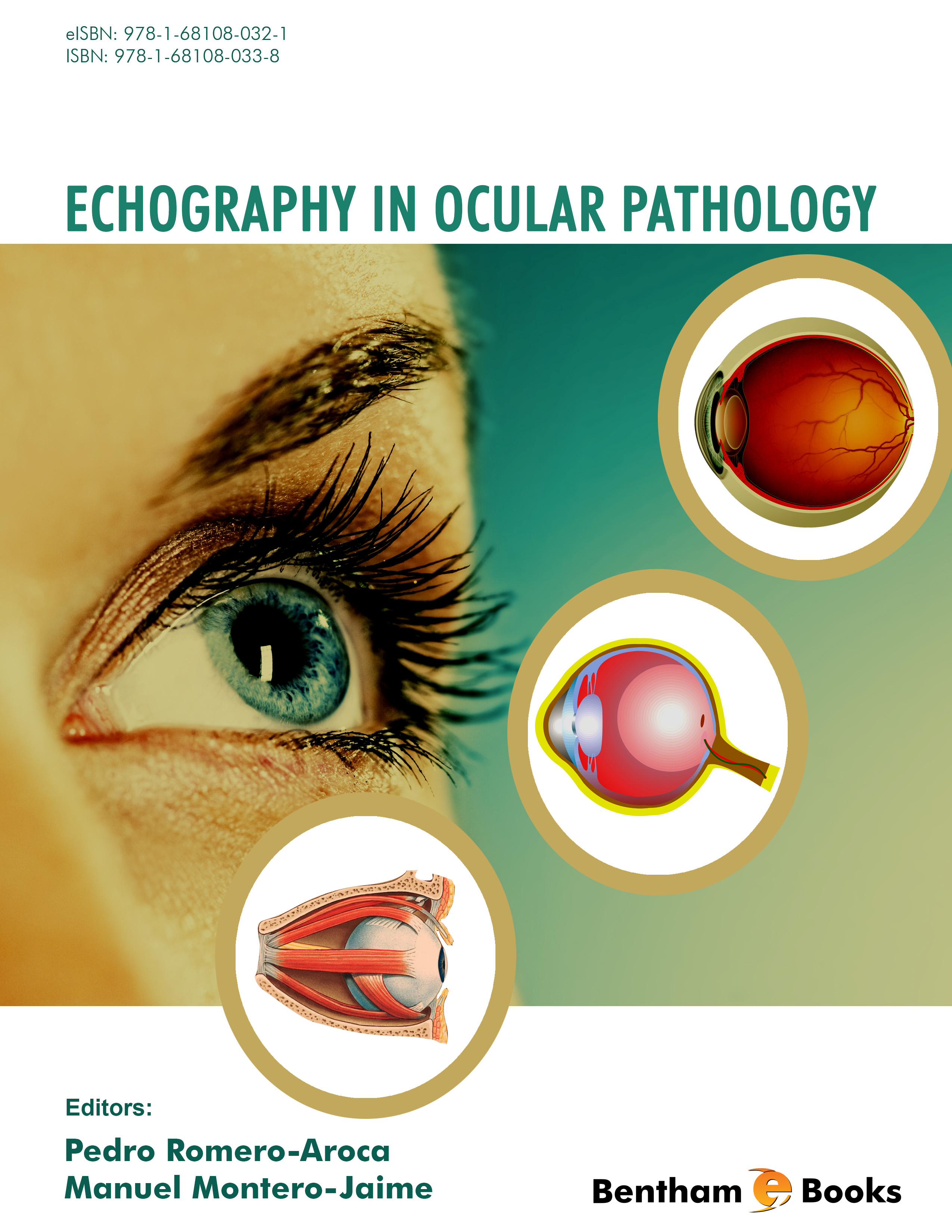 image of Echography in Ocular Pathology