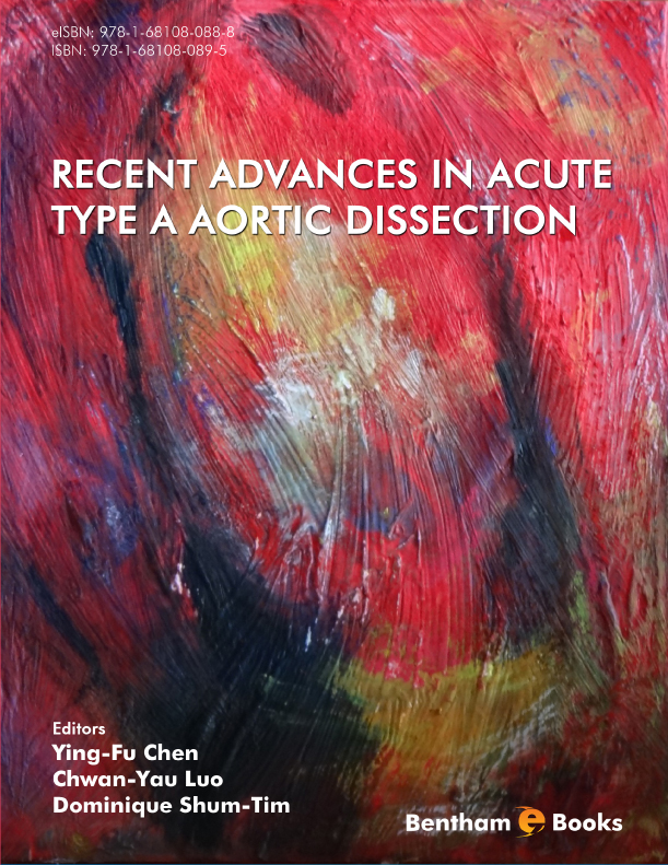 image of Recent Advances in Acute Type A Aortic Dissection