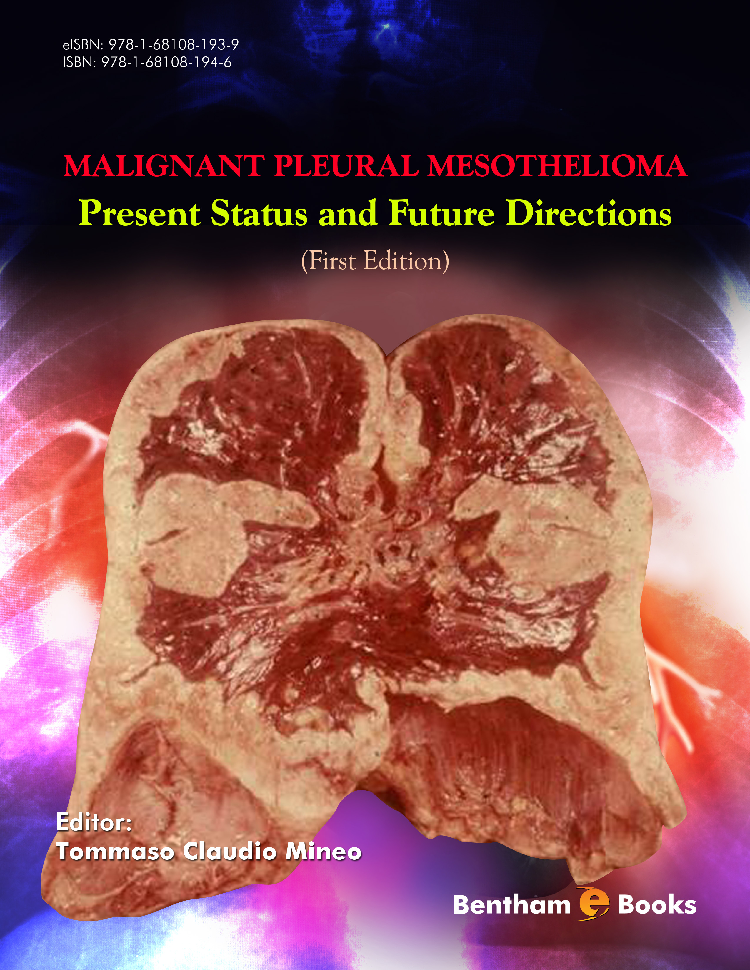 image of Malignant Pleural Mesothelioma: Present Status and Future Directions