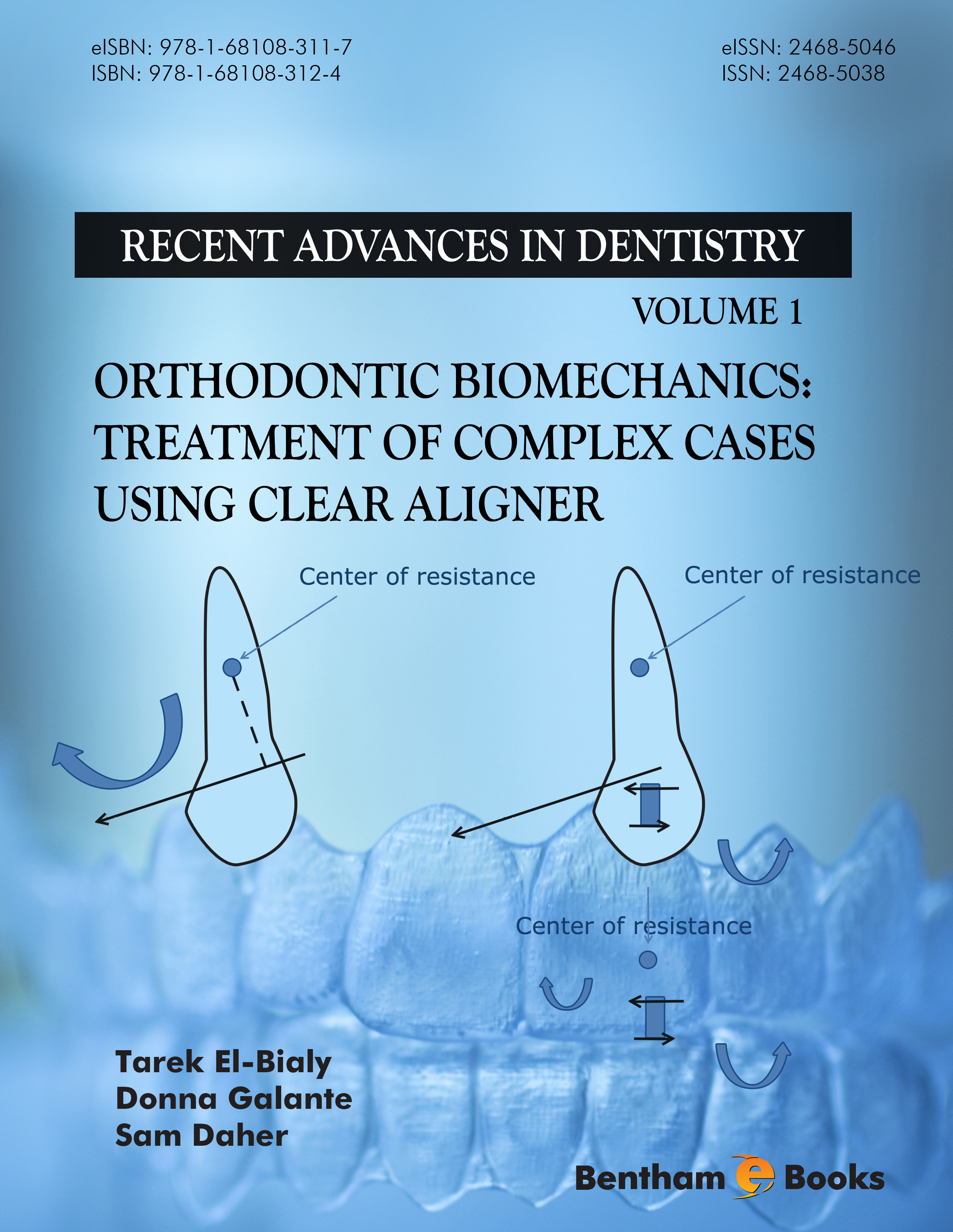 Orthodontic Biomechanics: Treatment of Complex Cases Using Clear Aligner Orthodontic Biomechanics: Treatment of Complex Cases Using Clear Aligner