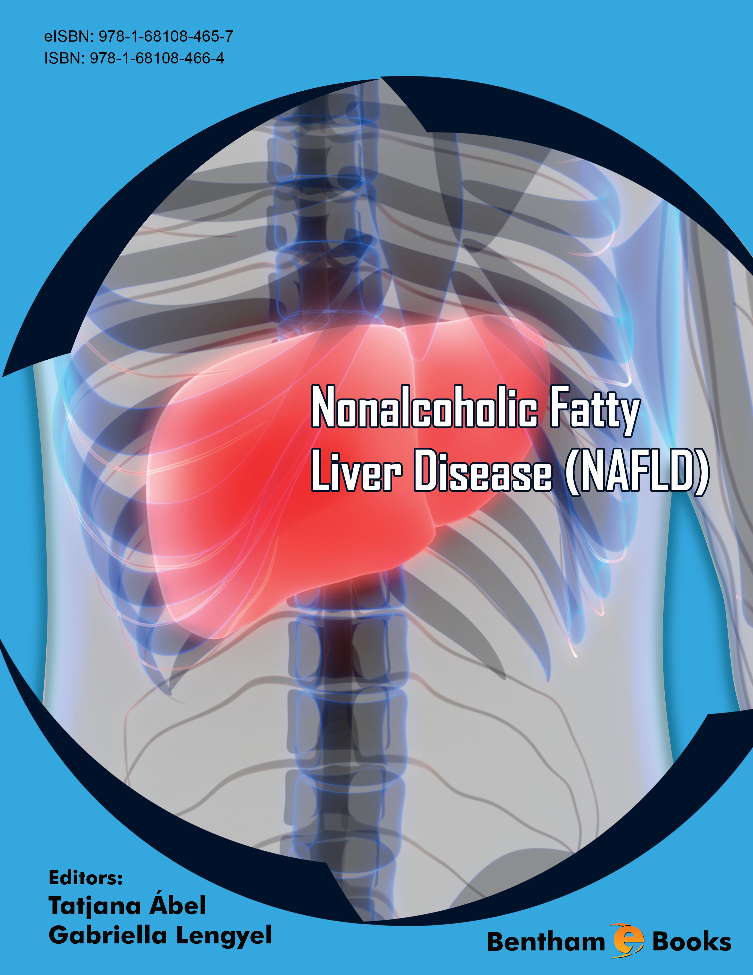 Nonalcoholic Fatty Liver Disease (NAFLD)