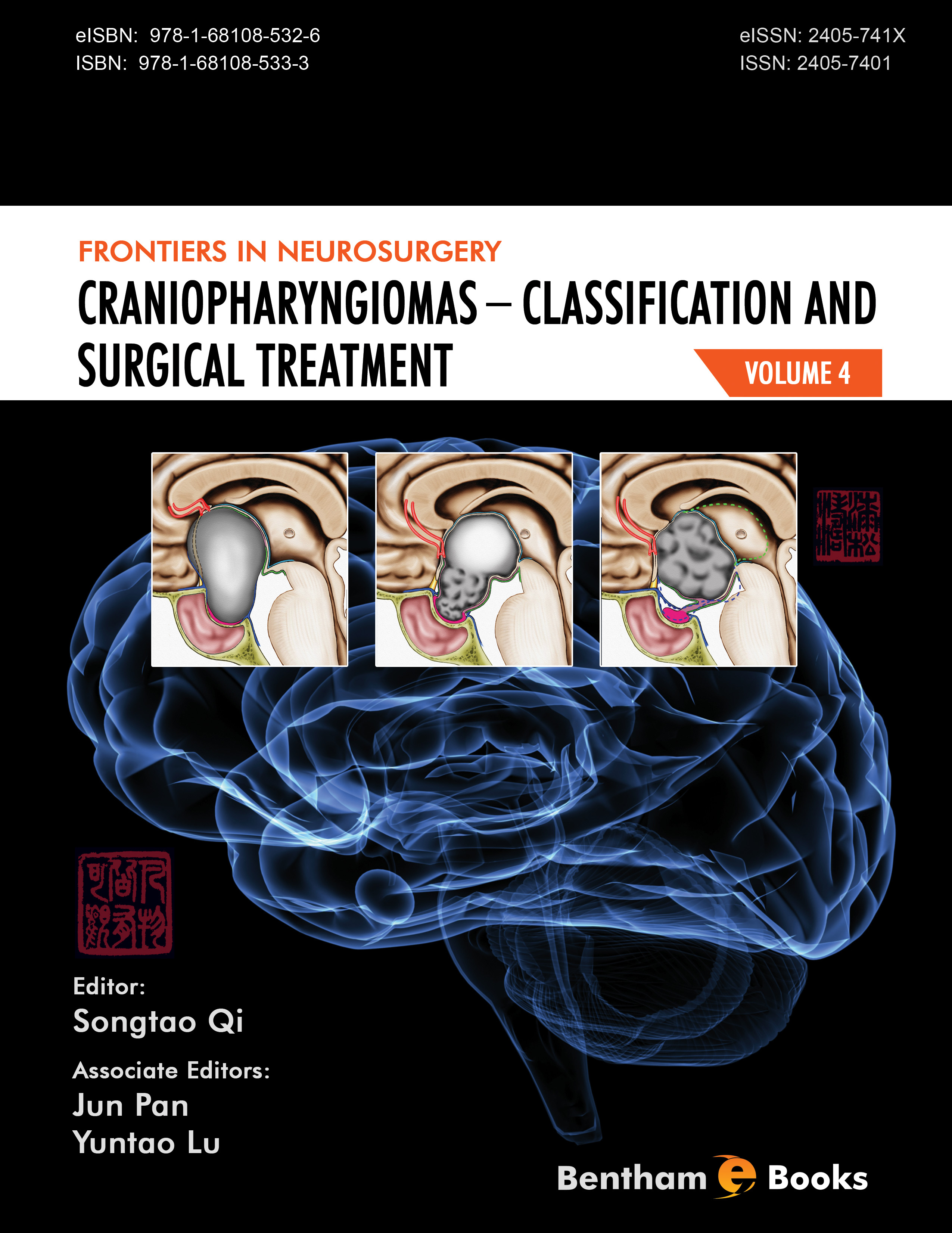 Craniopharyngiomas - Classification and Surgical Treatment Craniopharyngiomas - Classification and Surgical Treatment