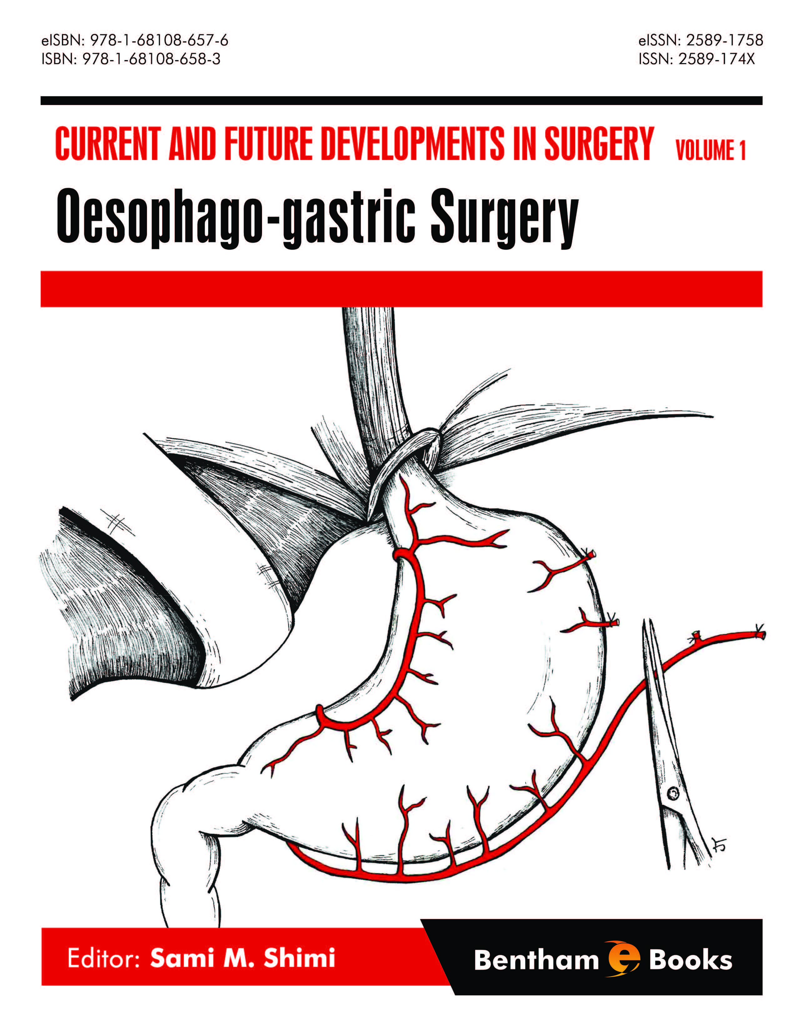 image of Oesophago-gastric Surgery