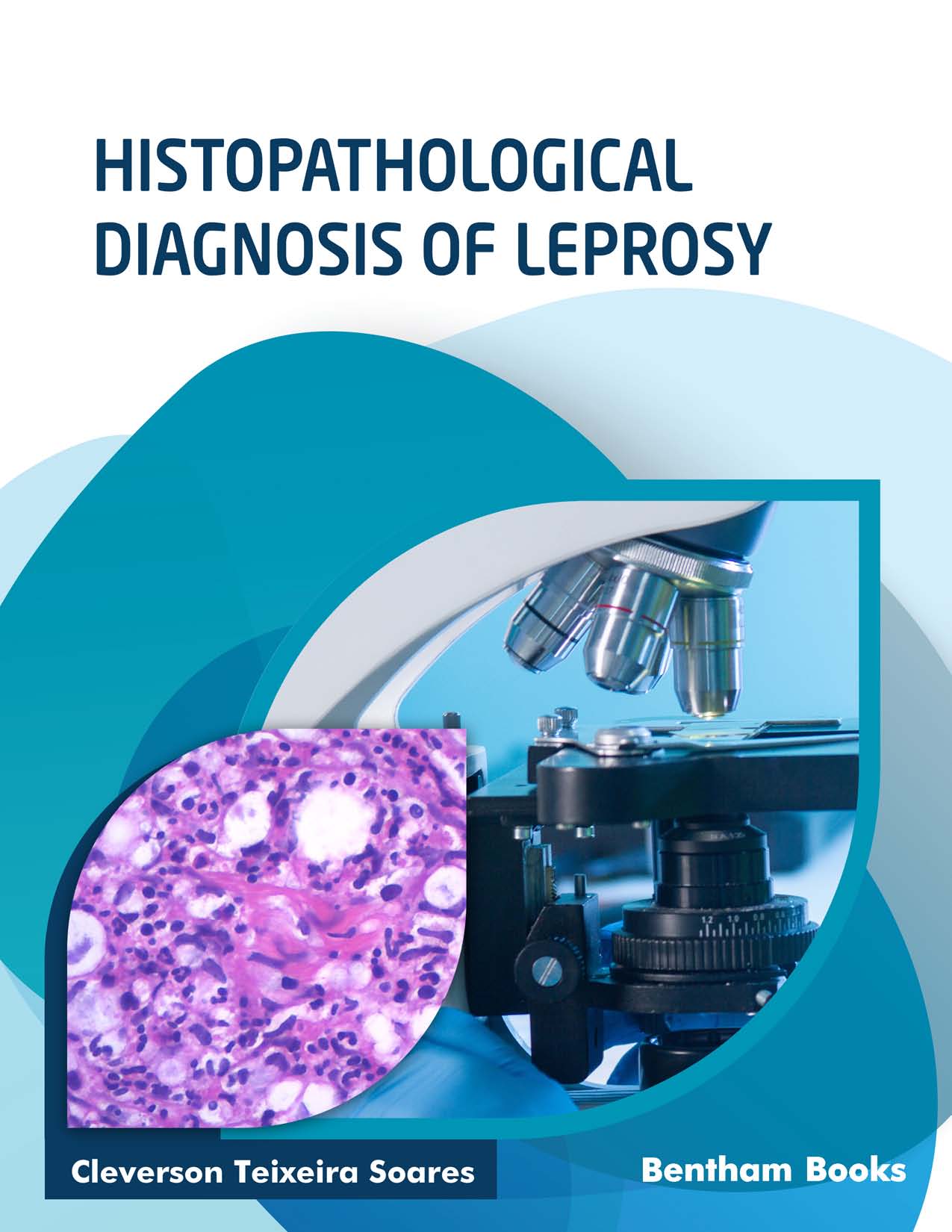 Histopathological Diagnosis of Leprosy Histopathological Diagnosis of Leprosy