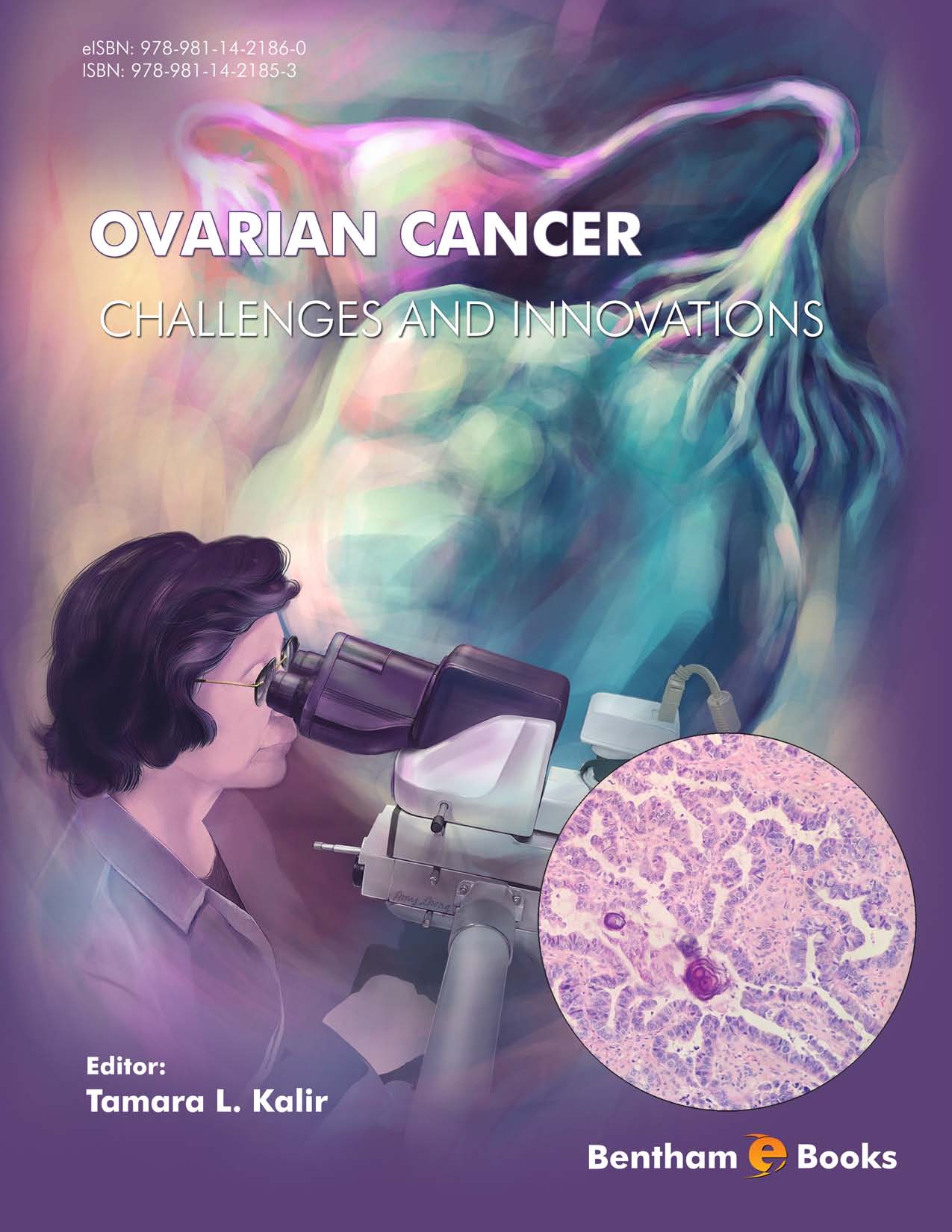 image of Ovarian Cancer-Challenges and Innovations