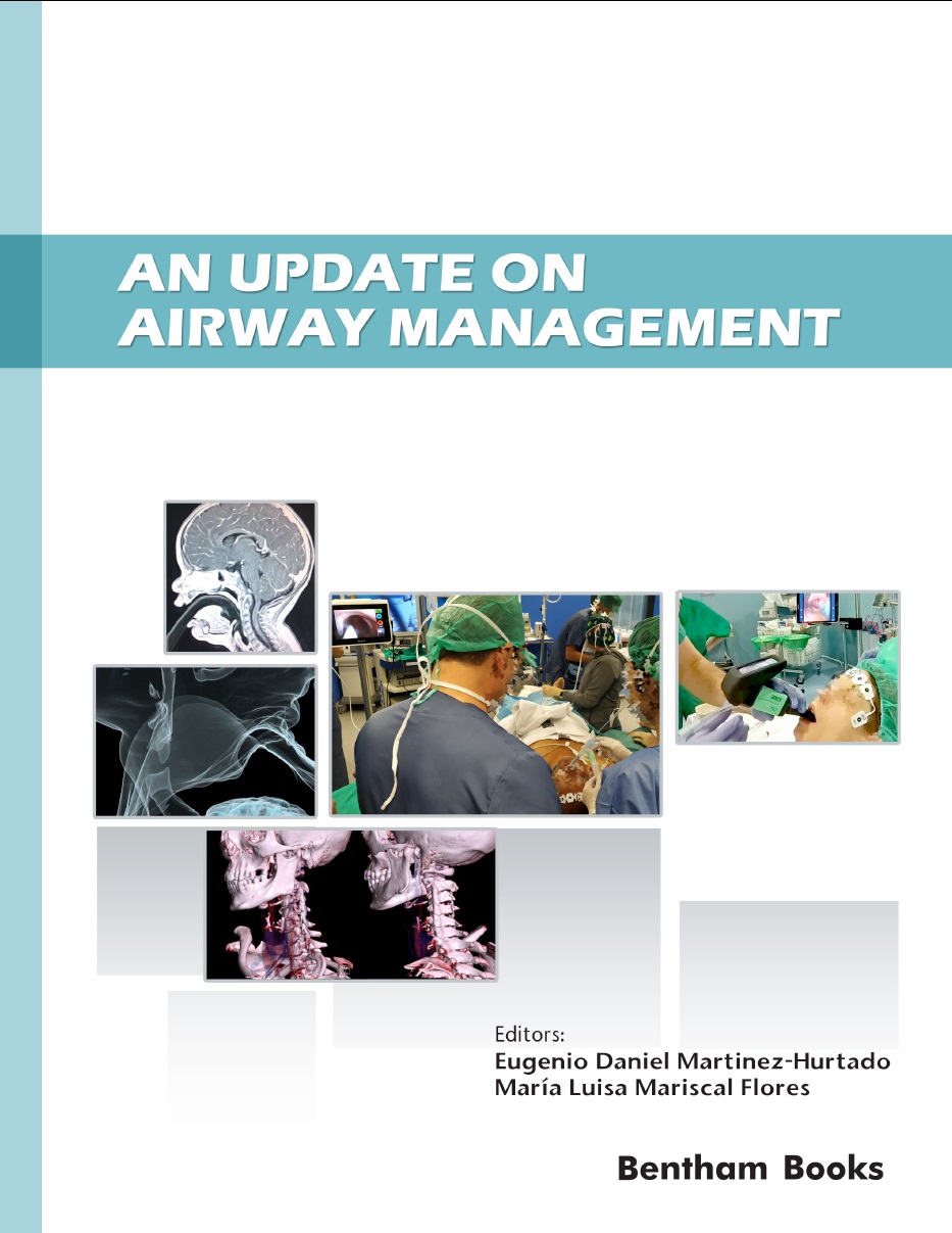 An Update on Airway Management An Update on Airway Management