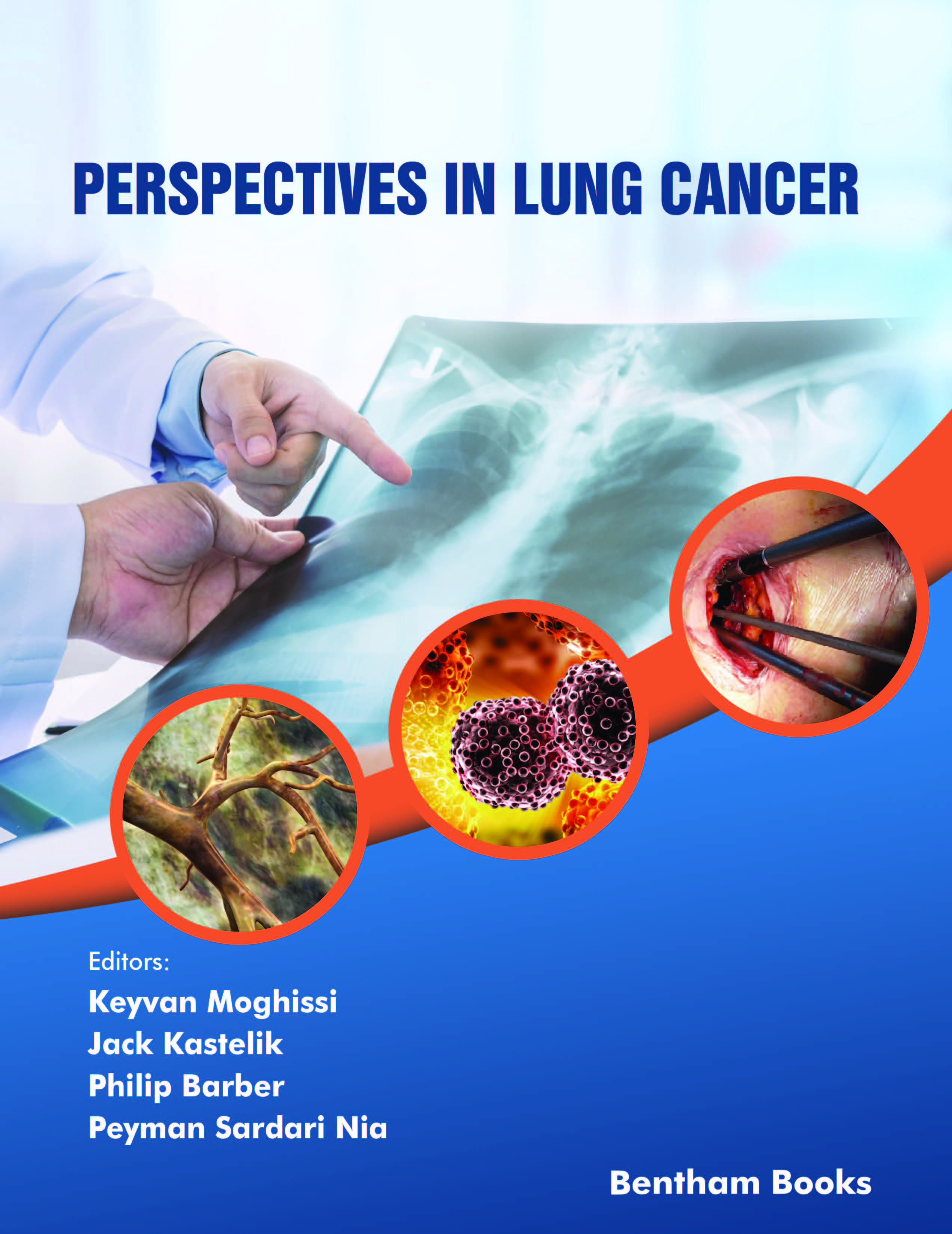Frontiers in Lung Cancer Frontiers in Lung Cancer