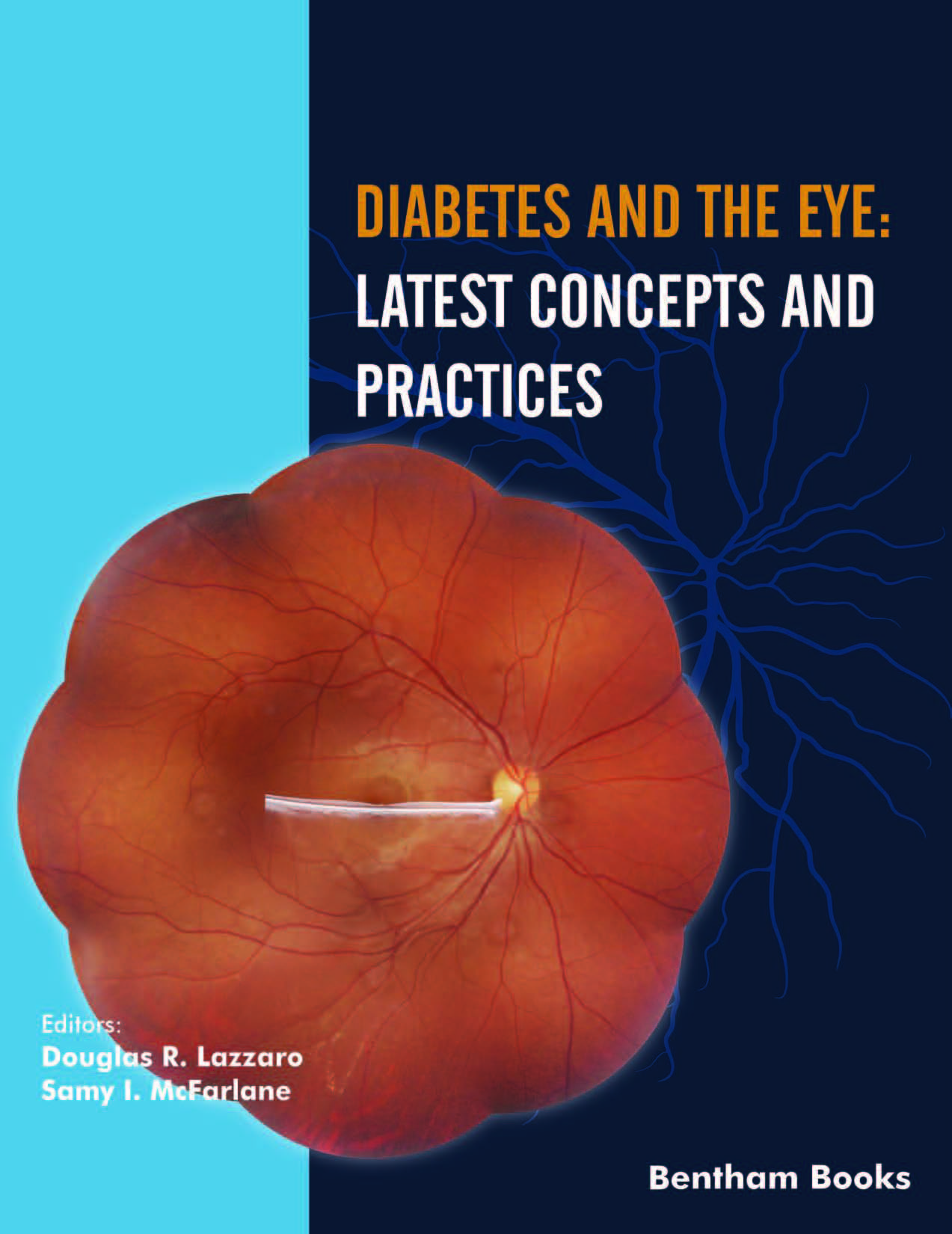 image of Diabetes and the Eye: Latest Concepts and Practices