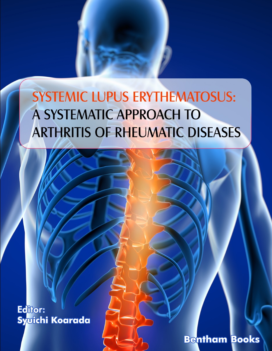 image of Systemic Lupus Erythematosus: A Systematic Approach to Arthritis of Rheumatic Diseases