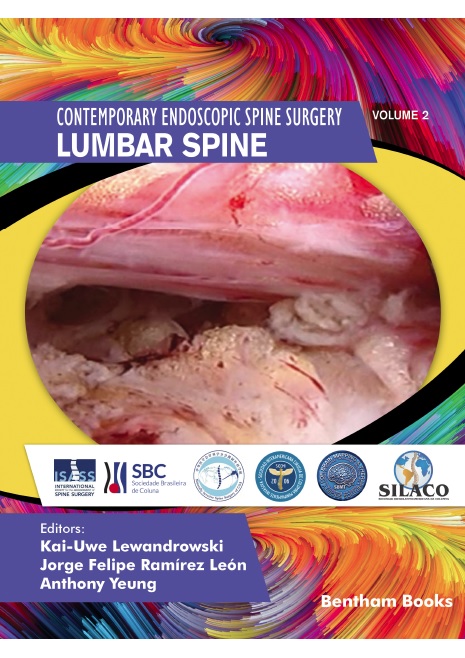 image of Lumbar Spine