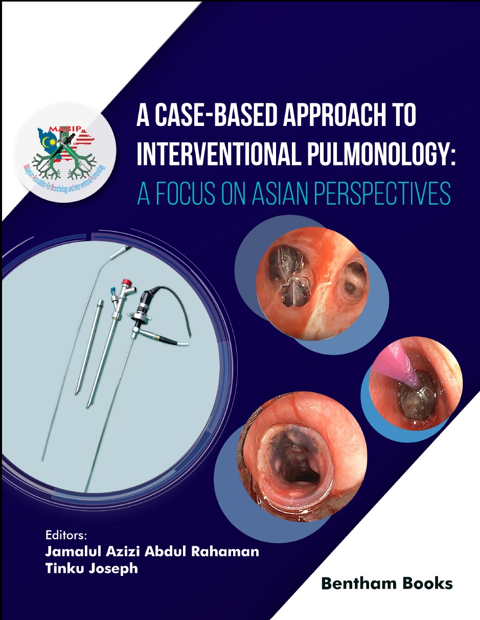 image of A Case-Based Approach to Interventional Pulmonology: A Focus on Asian Perspectives