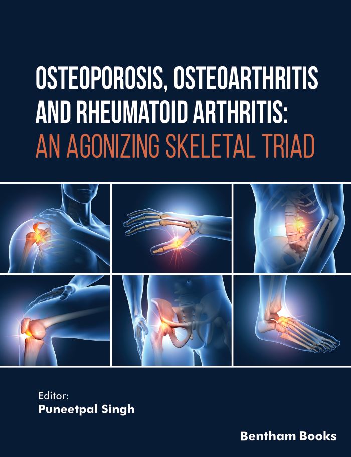 image of Osteoporosis, Osteoarthritis and Rheumatoid Arthritis: An Agonizing Skeletal Triad