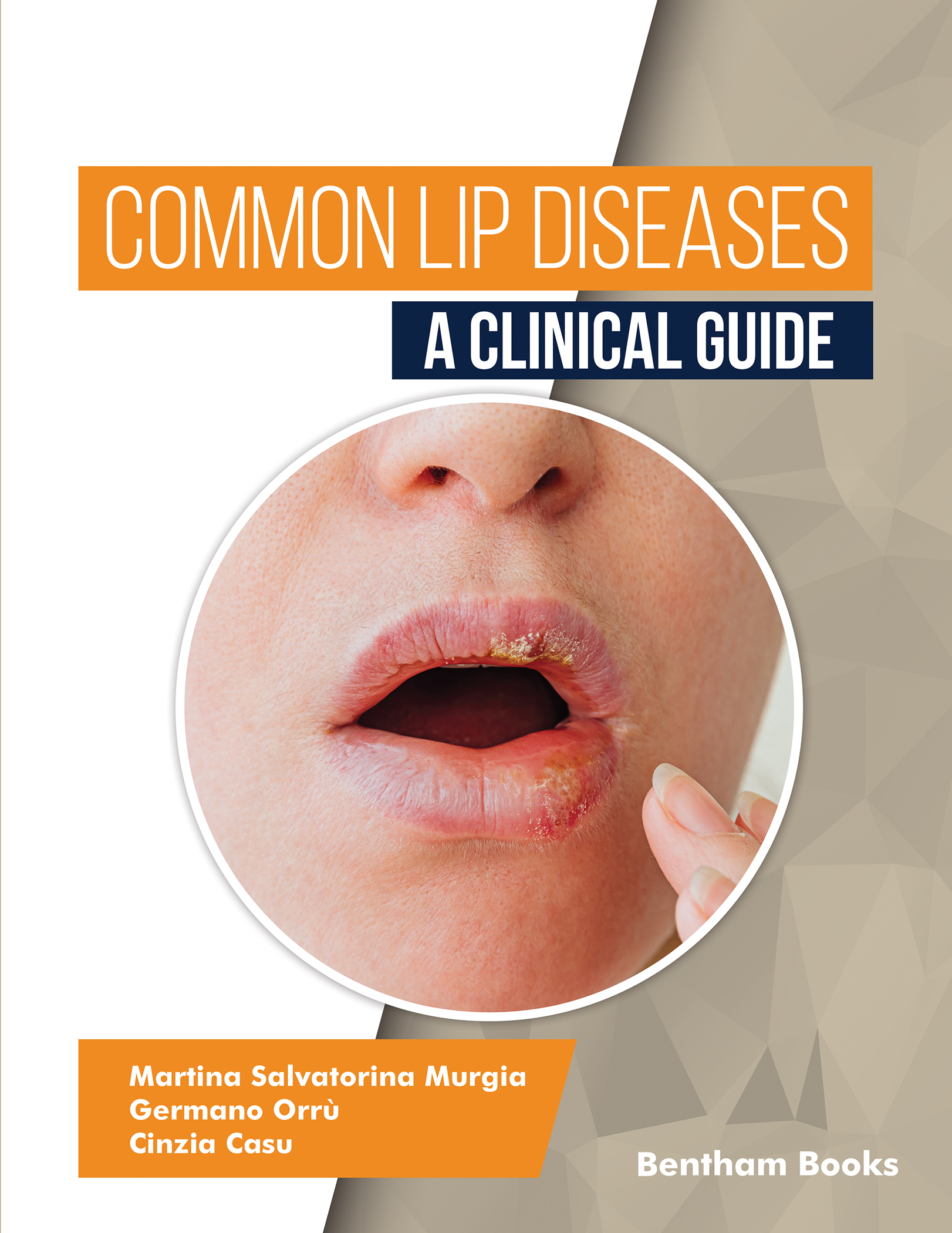 image of Common Lip Diseases: A Clinical Guide