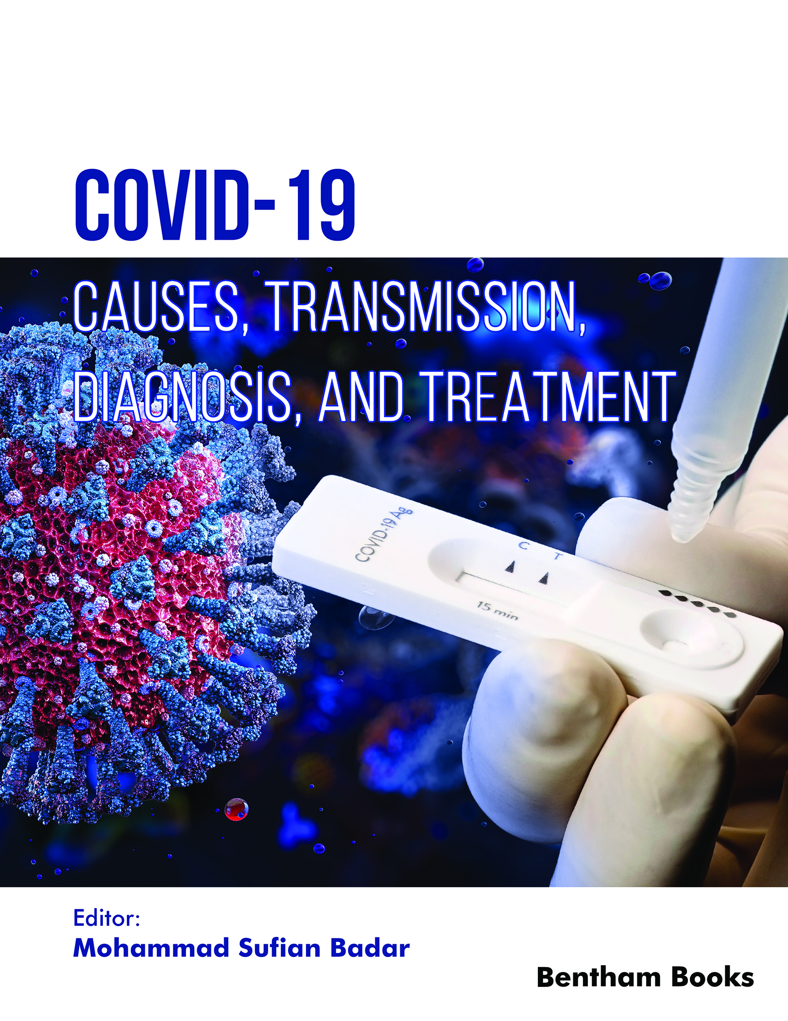 image of COVID-19: Causes, Transmission, Diagnosis, and Treatment